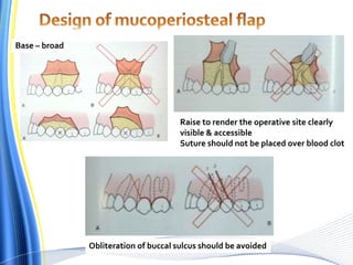 Raise to render the operative site clearly
visible & accessible
Suture should not be placed over blood clot
Obliteration of buccal sulcus should be avoided
Base – broad
 