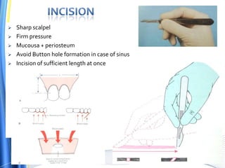  Sharp scalpel
 Firm pressure
 Mucousa + periosteum
 Avoid Button hole formation in case of sinus
 Incision of sufficient length at once
 
