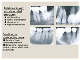 Relationship with
associated vital
structures:
■ Maxillary sinus
■ Inferior alveolar canal
■ Mental nerve
■ Adjacent teeth roots.
Condition of
surrounding bone:
■ Density of bone
surrounding the tooth
■ Dense bone—condensing
osteitis, sclerosis will increase
the difficulty.
 