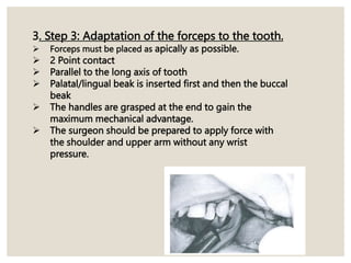 3. Step 3: Adaptation of the forceps to the tooth.
 Forceps must be placed as apically as possible.
 2 Point contact
 Parallel to the long axis of tooth
 Palatal/lingual beak is inserted first and then the buccal
beak
 The handles are grasped at the end to gain the
maximum mechanical advantage.
 The surgeon should be prepared to apply force with
the shoulder and upper arm without any wrist
pressure.
 