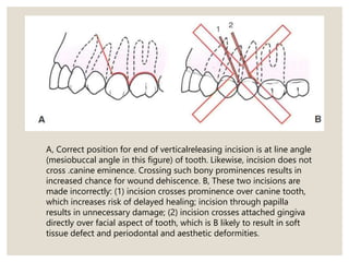 A, Correct position for end of verticalreleasing incision is at line angle
(mesiobuccal angle in this figure) of tooth. Likewise, incision does not
cross .canine eminence. Crossing such bony prominences results in
increased chance for wound dehiscence. B, These two incisions are
made incorrectly: (1) incision crosses prominence over canine tooth,
which increases risk of delayed healing; incision through papilla
results in unnecessary damage; (2) incision crosses attached gingiva
directly over facial aspect of tooth, which is B likely to result in soft
tissue defect and periodontal and aesthetic deformities.
 