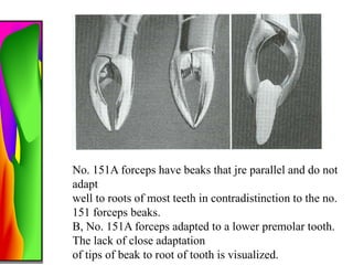 Parallel Forceps EXODONTIA technique and principles of tooth extraction | PPTX