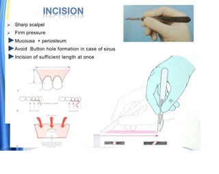 exodontia-ppt.pptx