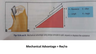 Mechanical Advantage = Rw/ra
 