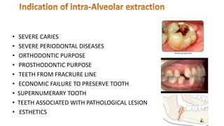 • SEVERE CARIES
• SEVERE PERIODONTAL DISEASES
• ORTHODONTIC PURPOSE
• PROSTHODONTIC PURPOSE
• TEETH FROM FRACRURE LINE
• ECONOMIC FAILURE TO PRESERVE TOOTH.
• SUPERNUMERARY TOOTH
• TEETH ASSOCIATED WITH PATHOLOGICAL LESION
• ESTHETICS
 
