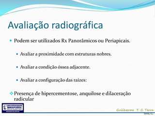 Avaliação radiográfica
 Podem ser utilizados Rx Panorâmicos ou Periapicais.

   Avaliar a proximidade com estruturas nobres.


   Avaliar a condição óssea adjacente.


   Avaliar a configuração das raízes:


 Presença de hipercementose, anquilose e dilaceração
  radicular

                                                        Terra, G.
 