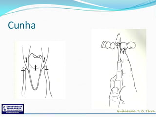 Cunha
 