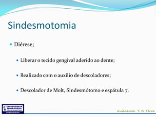Sindesmotomia
 Diérese;

   Liberar o tecido gengival aderido ao dente;


   Realizado com o auxílio de descoladores;


   Descolador de Molt, Sindesmótomo e espátula 7.
 