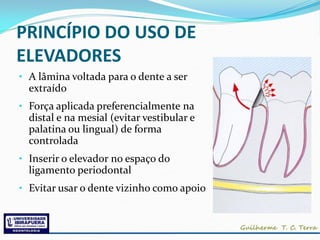 PRINCÍPIO DO USO DE
ELEVADORES
• A lâmina voltada para o dente a ser
  extraído
• Força aplicada preferencialmente na
  distal e na mesial (evitar vestibular e
  palatina ou lingual) de forma
  controlada
• Inserir o elevador no espaço do
  ligamento periodontal
• Evitar usar o dente vizinho como apoio
 