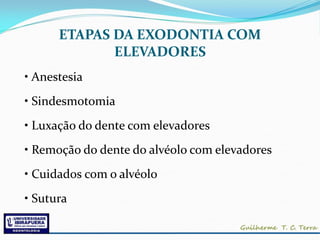 ETAPAS DA EXODONTIA COM
             ELEVADORES
• Anestesia
• Sindesmotomia
• Luxação do dente com elevadores
• Remoção do dente do alvéolo com elevadores
• Cuidados com o alvéolo
• Sutura
 