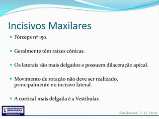 Incisivos Maxilares
 Fórceps nº 150.

 Geralmente têm raízes cônicas.

 Os laterais são mais delgados e possuem dilaceração apical.

 Movimento de rotação não deve ser realizado,
  principalmente no incisivo lateral.

 A cortical mais delgada é a Vestibular.
 