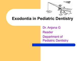 Exodontia in Pediatric Dentistry
Dr. Anjana G
Reader
Department of
Pediatric Dentistry
 