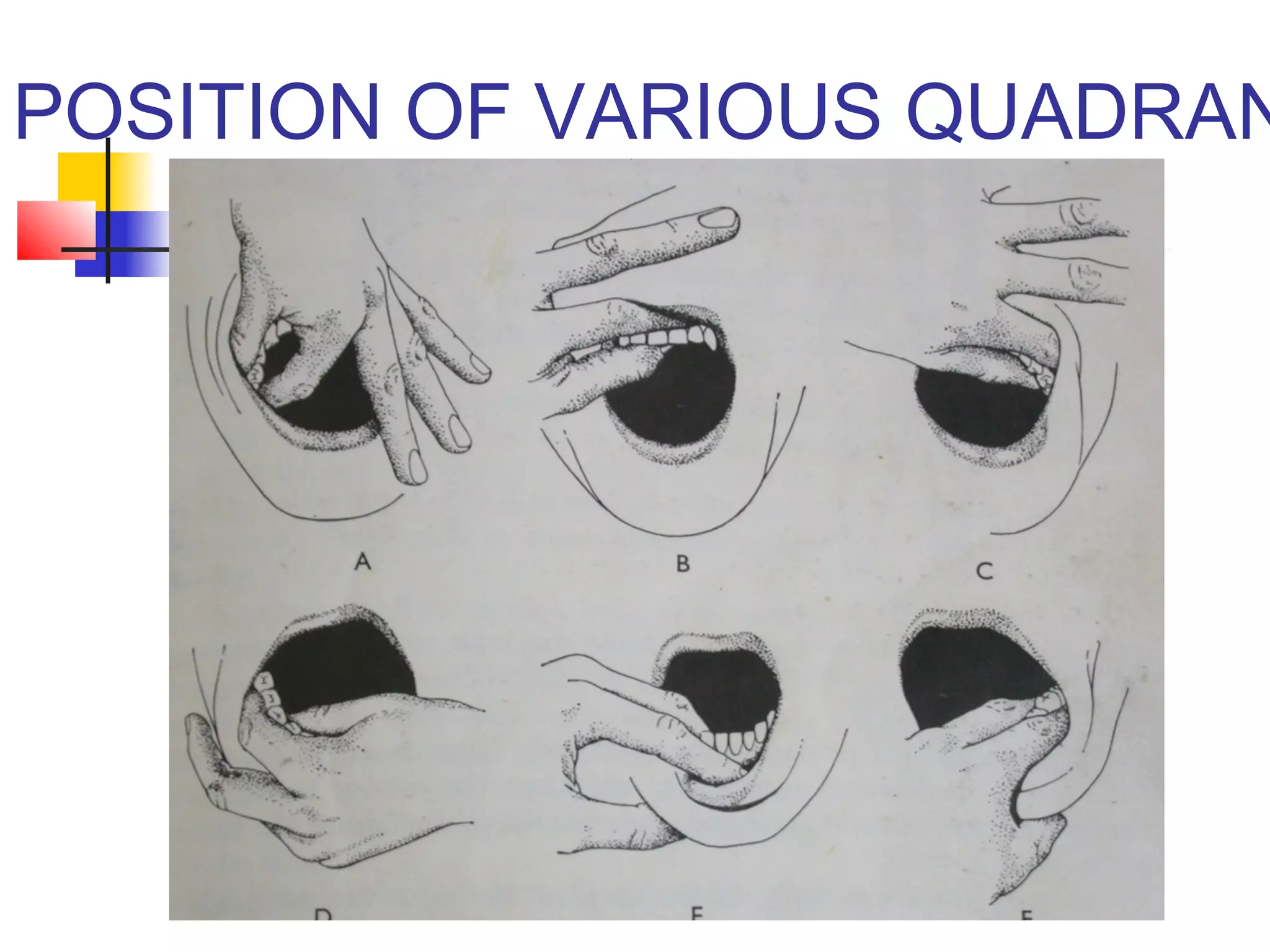 POSITION OF VARIOUS QUADRANT 
 