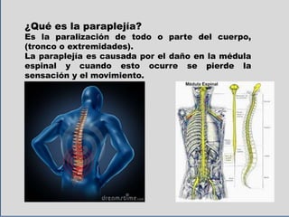 ¿Qué es la paraplejía?
Es la paralización de todo o parte del cuerpo,
(tronco o extremidades).
La paraplejía es causada por el daño en la médula
espinal y cuando esto ocurre se pierde la
sensación y el movimiento.
 