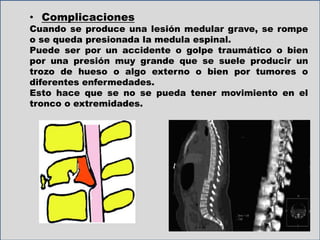 • Complicaciones
Cuando se produce una lesión medular grave, se rompe
o se queda presionada la medula espinal.
Puede ser por un accidente o golpe traumático o bien
por una presión muy grande que se suele producir un
trozo de hueso o algo externo o bien por tumores o
diferentes enfermedades.
Esto hace que se no se pueda tener movimiento en el
tronco o extremidades.
 