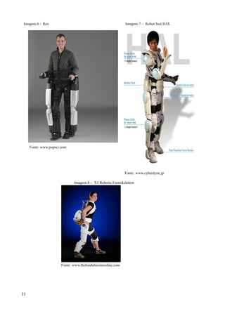 Imagem.6 – Rex

Imagem.7 – Robot Suit HAL

Fonte: www.popsci.com

Fonte: www.cyberdyne.jp
Imagem.8 – X1 Robotic Exoeskeletion

Fonte: www.thehindubusinessline.com

11

 