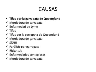 CAUSAS
• Tifus por la garrapata de Queensland
 Mordedura de garrapata
 Enfermedad de Lyme
 Tifus
 Tifus por la garrapata de Queensland
 Mordedura de garrapata
 STARI
 Parálisis por garrapata
 Rickettsia
 Enfermedades contagiosas
 Mordedura de garrapata
 