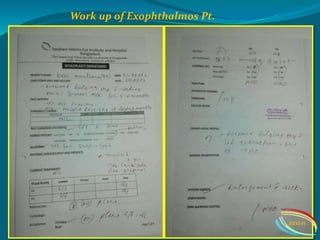 Work up of Exophthalmos Pt.
IIEI&H
 