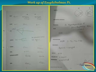 Work up of Exophthalmos Pt.
IIEI&H
 
