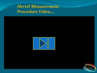 Hertel Measurement
Procedure Video….
IIEI&H
 
