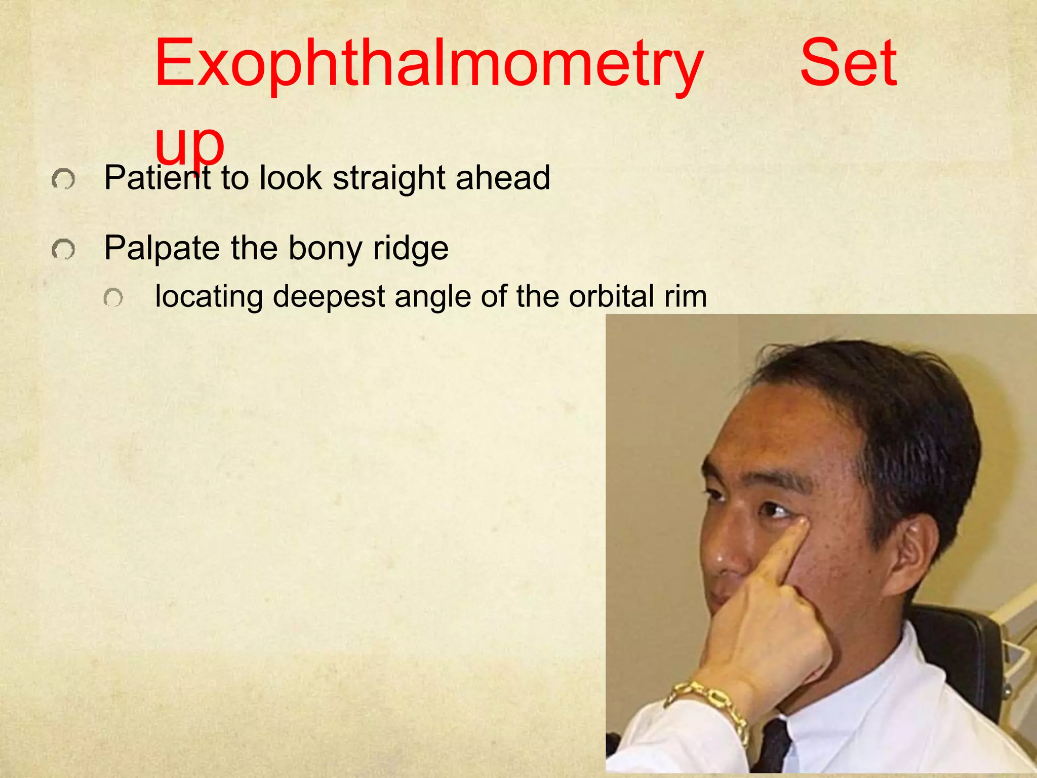 Exophthalmometry | PPTX