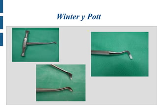 Winter y Pott
.

.

 
