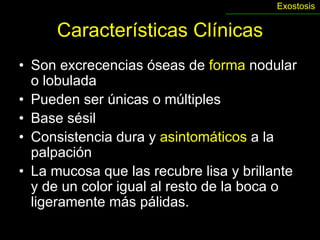 Exostosis


      Características Clínicas
• Son excrecencias óseas de forma nodular
  o lobulada
• Pueden ser únicas o múltiples
• Base sésil
• Consistencia dura y asintomáticos a la
  palpación
• La mucosa que las recubre lisa y brillante
  y de un color igual al resto de la boca o
  ligeramente más pálidas.
 