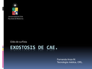 EXOSTOSIS DE CAE.
Oído de surfista
Universidad de Chile
Facultad de Medicina
Fernanda Anza M.
Tecnología médica, ORL.
 