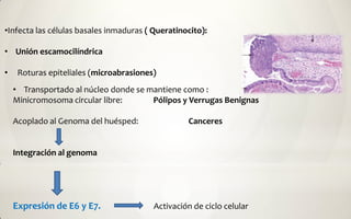 •Infecta las células basales inmaduras ( Queratinocito):

• Unión escamocilíndrica

•    Roturas epiteliales (microabrasiones)
    • Transportado al núcleo donde se mantiene como :
    Minicromosoma circular libre:      Pólipos y Verrugas Benignas

    Acoplado al Genoma del huésped:               Canceres


    Integración al genoma




    Expresión de E6 y E7.                Activación de ciclo celular
 