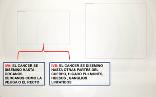 IVA: EL CANCER SE   IVB: EL CANCER SE DISEMINO
DISEMINO HASTA      HASTA OTRAS PARTES DEL
ORGANOS             CUERPO, HIGADO PULMONES,
CERCANOS COMO LA    HUESOS , GANGLIOS
VEJIGA O EL RECTO   LINFATICOS
 