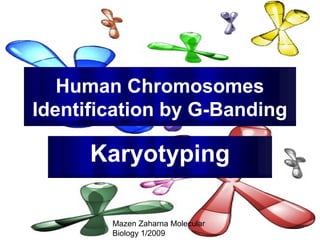 Human Chromosomes
Identification by G-Banding

Karyotyping
Mazen Zaharna Molecular
Biology 1/2009

 