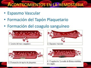 ACONTECIMIENTOS EN LA HEMOSTASIA
• Espasmo Vascular
• Formación del Tapón Plaquetario
• Formación del coagulo sanguíneo
 