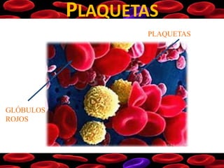 PLAQUETAS
PLAQUETAS
GLÓBULOS
ROJOS
 