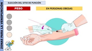 ZONAS
PARA
LA
VENOPUNCIÓN ELECCIÓN DEL SITIO DE PUNCIÓN
PESO EN PERSONAS OBESAS
 