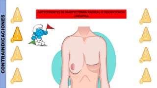 CONTRAINDICACIONES
ANTECEDENTES DE MASTECTOMÍA RADICAL O INSUFICIENCIA
LINFATICA
 