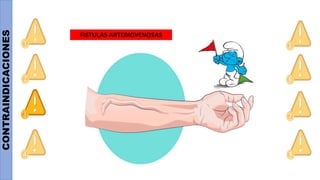 CONTRAINDICACIONES
FISTULAS ARTERIOVENOSAS
 