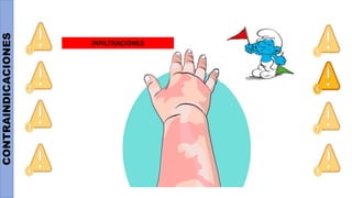 CONTRAINDICACIONES
INFILTRACIONES
 