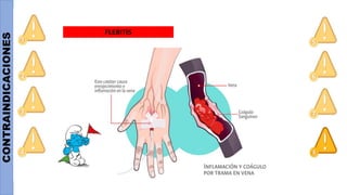 CONTRAINDICACIONES
FLEBITIS
 