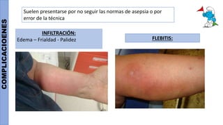 COMPLICACIOENES
Suelen presentarse por no seguir las normas de asepsia o por
error de la técnica
INFILTRACIÓN:
Edema – Frialdad - Palidez
 
