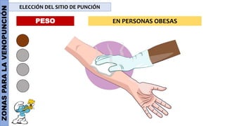 ZONAS
PARA
LA
VENOPUNCIÓN ELECCIÓN DEL SITIO DE PUNCIÓN
PESO EN PERSONAS OBESAS
 