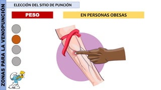 ZONAS
PARA
LA
VENOPUNCIÓN ELECCIÓN DEL SITIO DE PUNCIÓN
PESO EN PERSONAS OBESAS
 