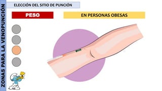 ZONAS
PARA
LA
VENOPUNCIÓN ELECCIÓN DEL SITIO DE PUNCIÓN
PESO EN PERSONAS OBESAS
 