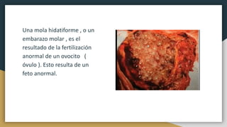 Una mola hidatiforme , o un
embarazo molar , es el
resultado de la fertilización
anormal de un ovocito (
óvulo ). Esto resulta de un
feto anormal.
 
