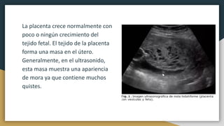 La placenta crece normalmente con
poco o ningún crecimiento del
tejido fetal. El tejido de la placenta
forma una masa en el útero.
Generalmente, en el ultrasonido,
esta masa muestra una apariencia
de mora ya que contiene muchos
quistes.
 