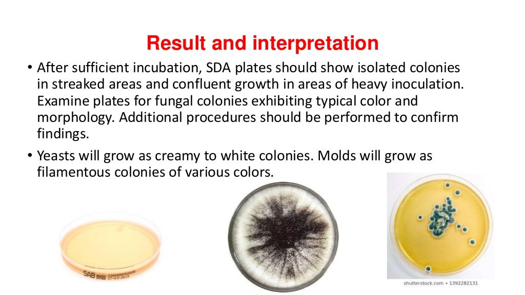 Preparation of fungal culture media