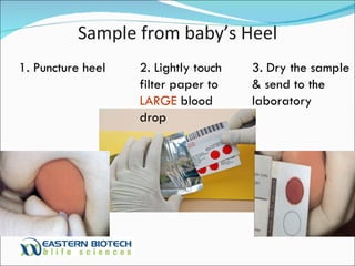 Sample from baby’s Heel 1. Puncture heel 2. Lightly touch filter paper to  LARGE  blood drop 3. Dry the sample & send to the laboratory 