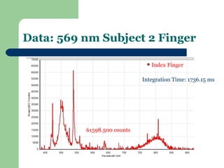 Data: 569 nm Subject 2 Finger

                                Index Finger

                             Integration Time: 1736.15 ms




          61598.500 counts
 