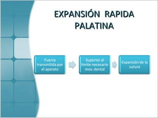 EXPANSIÓN  RAPIDA PALATINA 