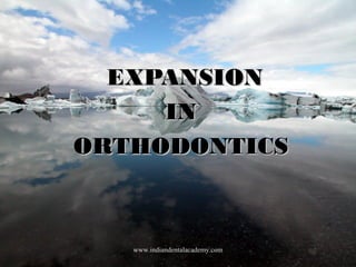 EXPANSION
IN
ORTHODONTICS

www.indiandentalacademy.com

 