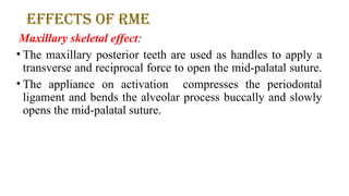 Comprehensive Overview of Expansion Techniques in Orthodontics: Rapid ...